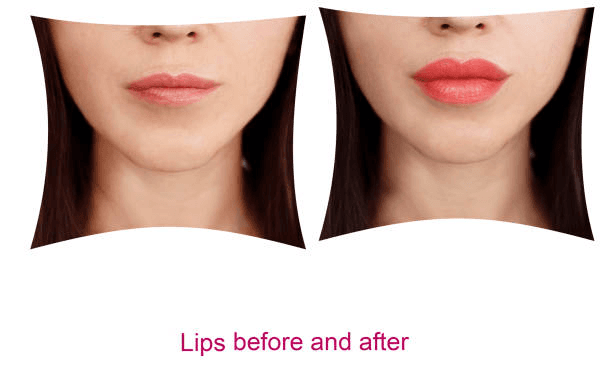 Non-Surgical Results