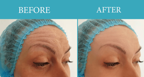 Reconstructive Results