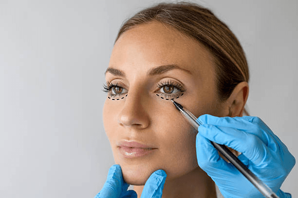 Upper eyelid comparison reference for blepharoplasty