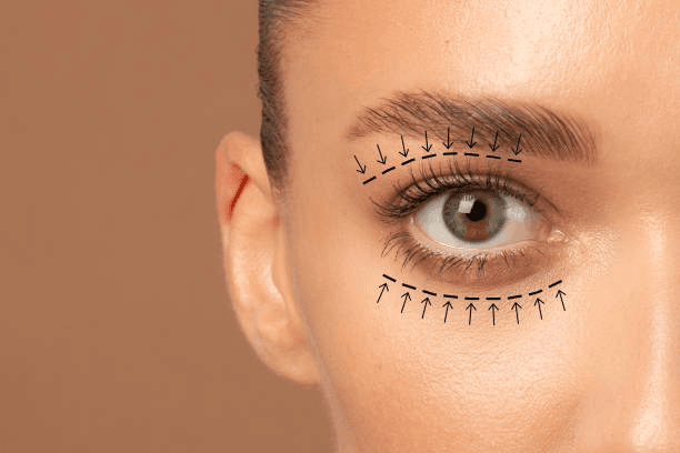 Blepharoplasty in Peshawar eye analysis