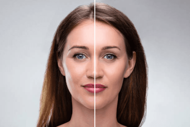Facial symmetry and brow comparison reference