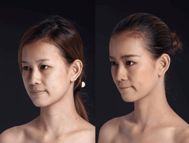 Front chin balance comparison for facial symmetry