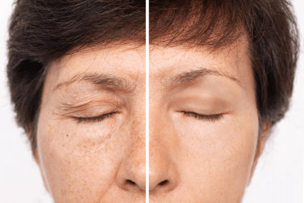 Woman examining facial aging signs โ consultation for Deep Plane Facelift in Peshawar