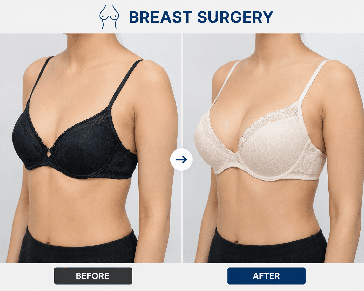 Breast surgery procedures – augmentation lift reduction Peshawar
