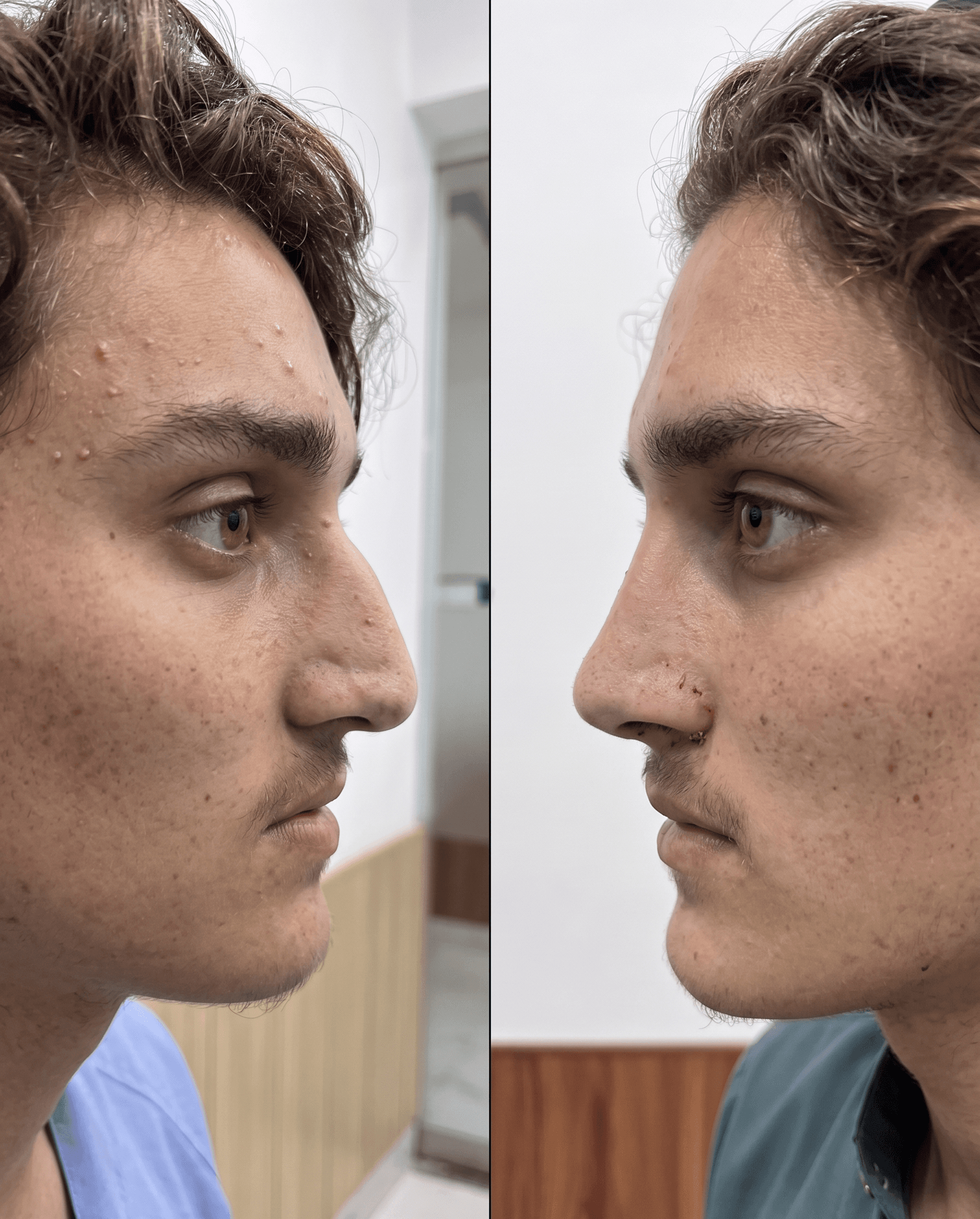 Male aesthetic procedures – facial contouring hair restoration injectables Peshawar