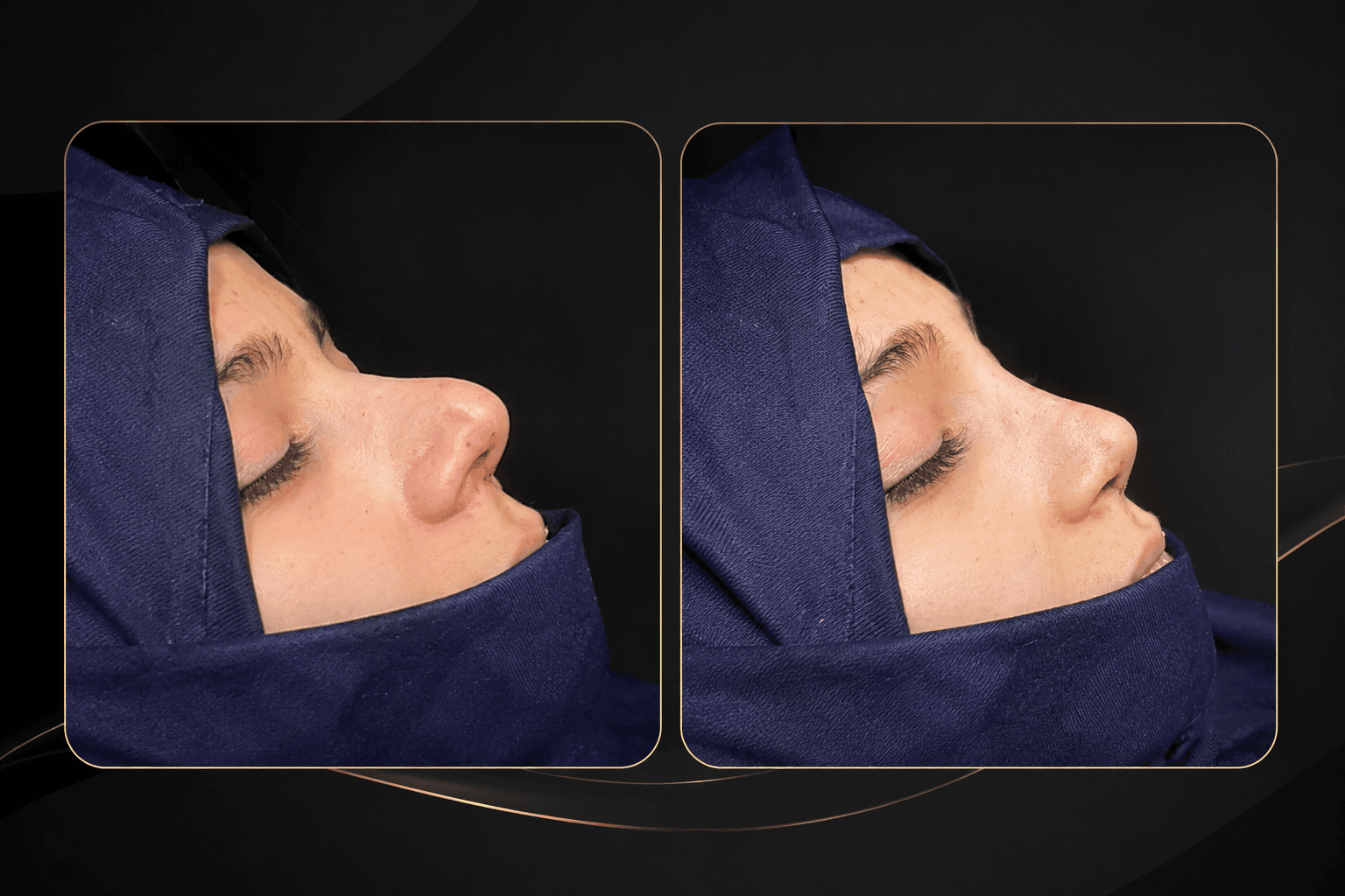 Miami Plastic Surgery & Hair Transplant Center – signature transformations Peshawar